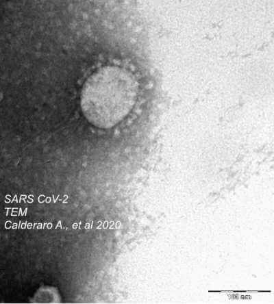 Su “International Journal of Infectious Diseases” il primo caso di isolamento da lattante del coronavirus SARS-CoV-2 all’Università di Parma