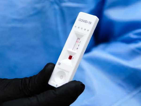COVID 19, test sierologici sul posto di lavoro: i chiarimenti del Garante Privacy