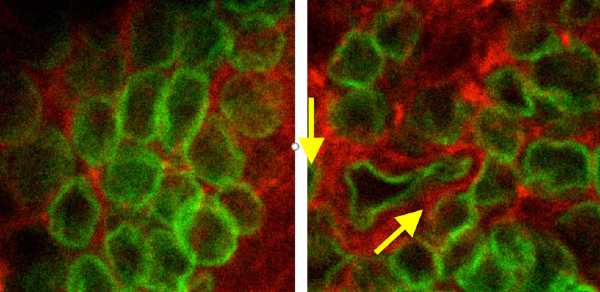 Guardare al nucleo delle cellule per comprendere l’Alzheimer Guardare al nucleo delle cellule per comprendere l’Alzheimer