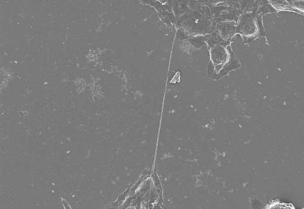 Nanofili di carburo di silicio per curare l’infarto al cuore: ricerca guidata dall’Università di Parma