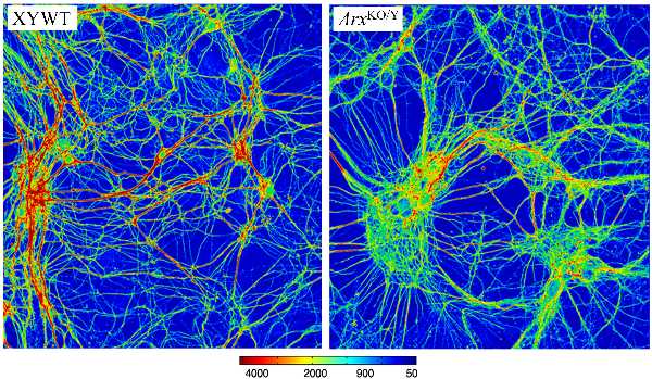 Identificati i difetti molecolari di due patologie neurologiche